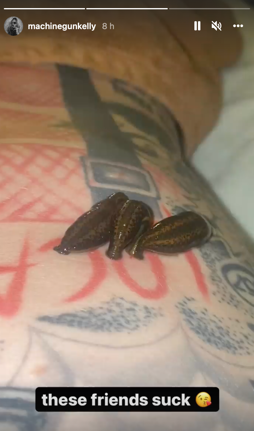 Machine Gun Kelly Posts Video Of Leeches Sucking His Tattoos