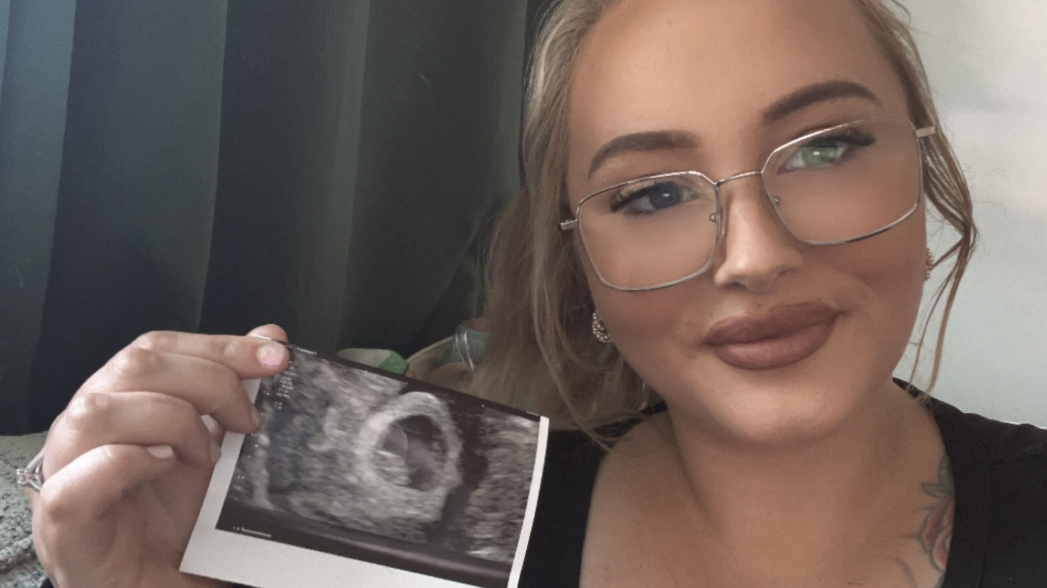 Woman's warning after getting pregnant on popular weight loss drug while  taking the pill