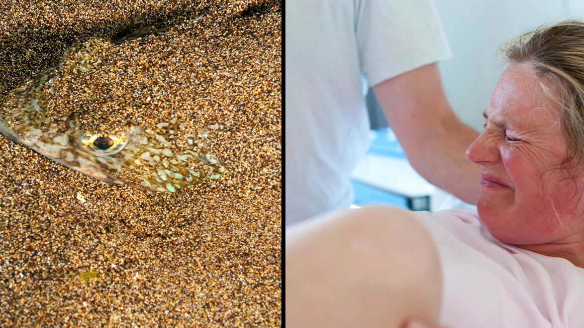 Pain From 'Britain's Most Toxic Fish' Sting Compared To Childbirth - Vimarsana News