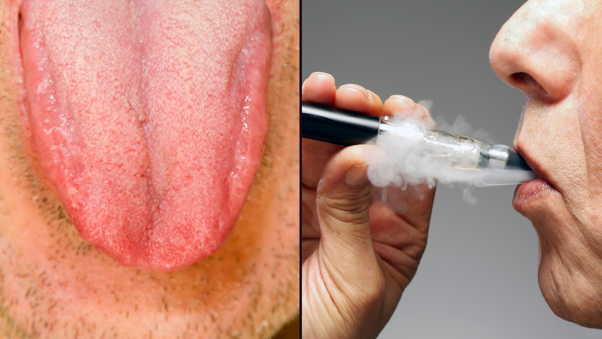 elfbar elfa kaufen Expert reveals shocking long-term side effect of 'Vaper's Tongue' that will  put many people off