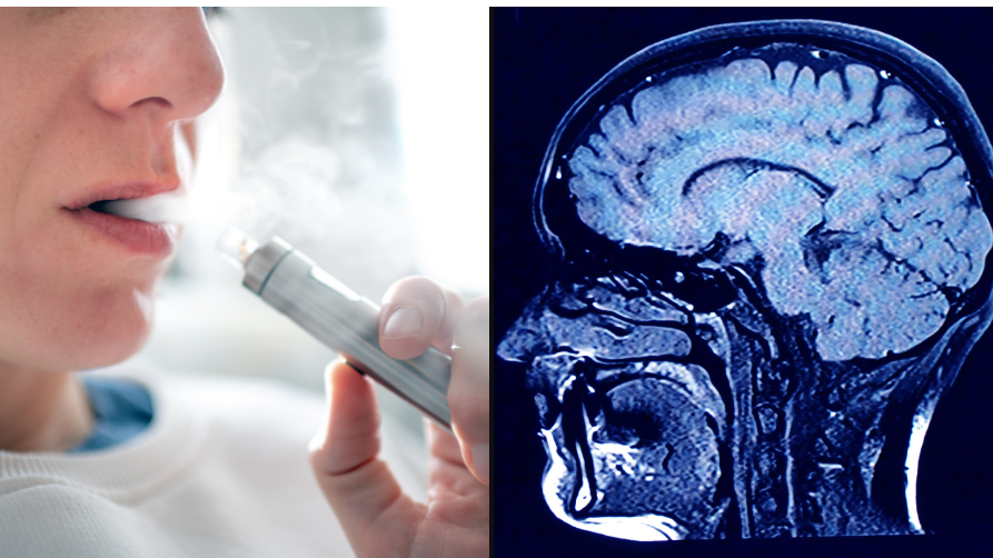 brains smoke and vape Vapes en Peru | Vuse main image 1