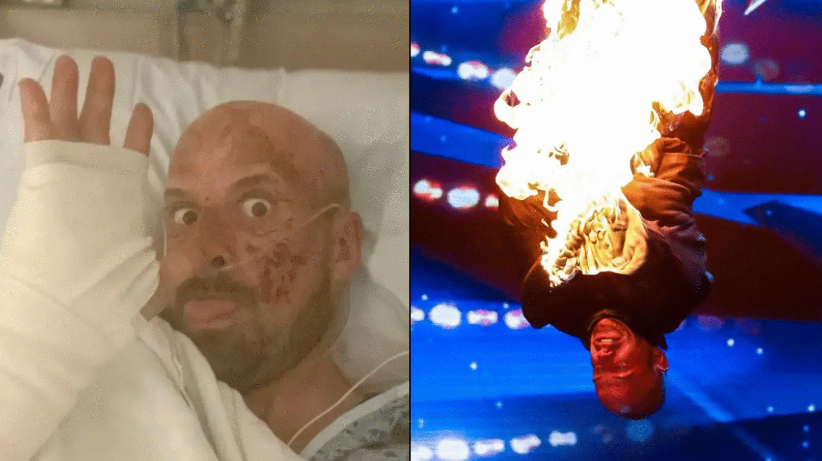 Former Britain's Got Talent Star Left Paralysed After Stunt Goes Wrong