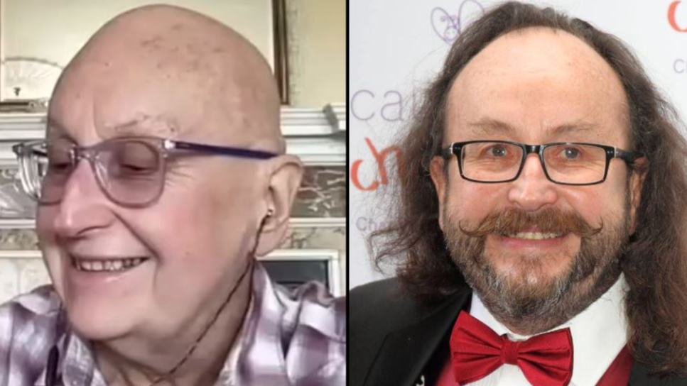 Hairy Bikers' Dave Myers Says He's Lost Iconic Beard In Cancer Update ...