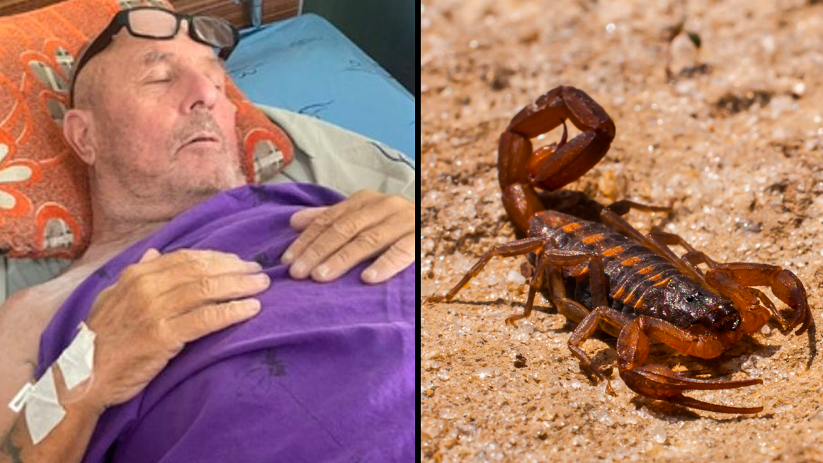 Brit dad could lose leg after being stung by a scorpion - TrendRadars