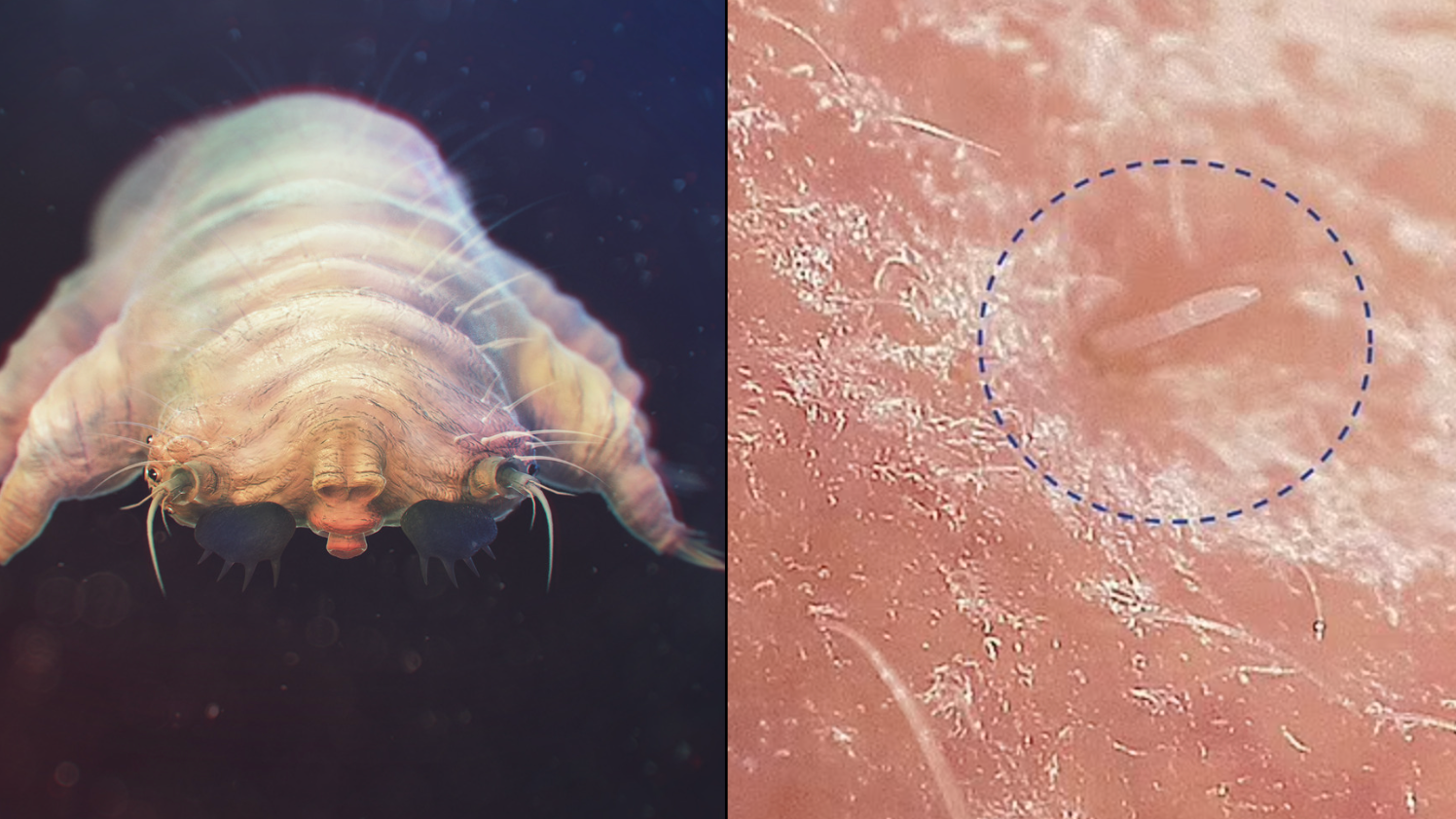 These Mites Have Sex On Your Face And Nipples While You Sleep Trendradars Latest