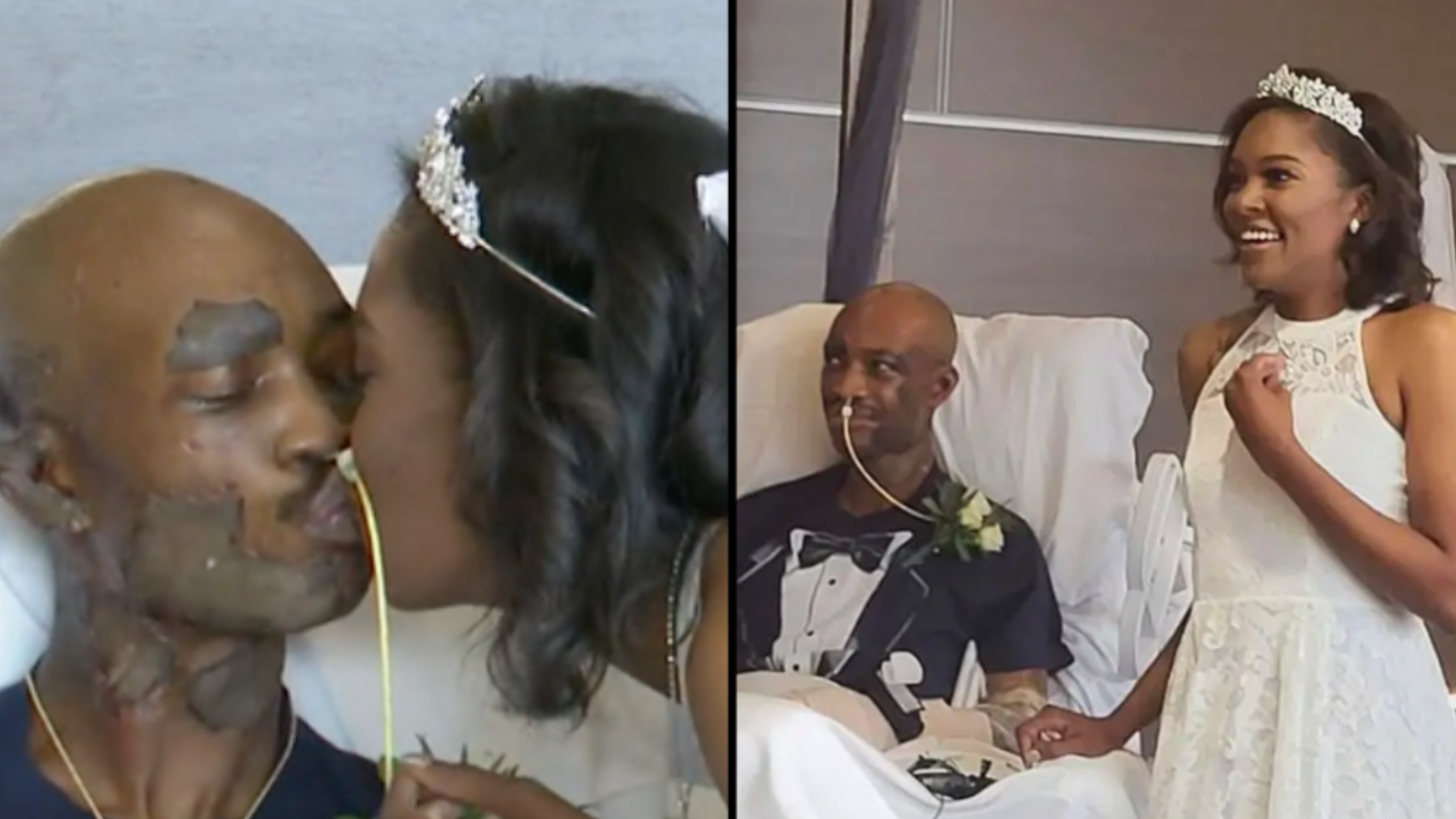 Couple get married in hospital burns unit after groom suffered horrific  accident just before their wedding