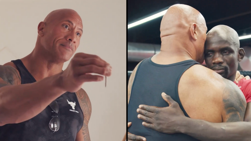 Dwayne Johnson had male breast reduction surgery to eliminate the