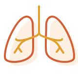 Venenverschlusskrankheit, pulmonale kapilläre Hämangiomatose: Illustration Lunge