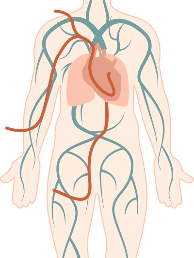 Diagnose - Katheter-Untersuchung