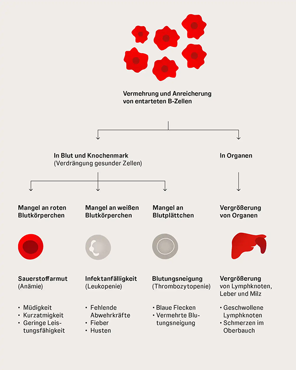 Der Prozess im Detail