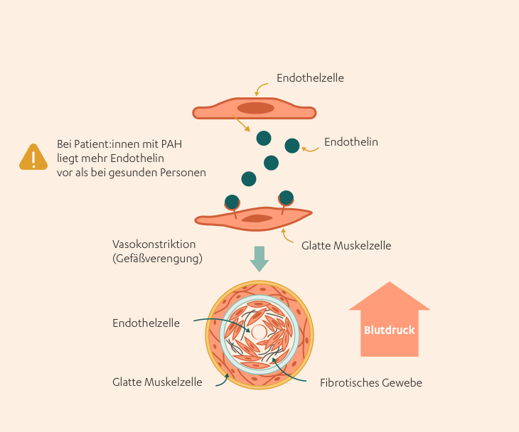 Prostacyclin: Illustration medikamentoese therapie ohne rezeptorantagonist