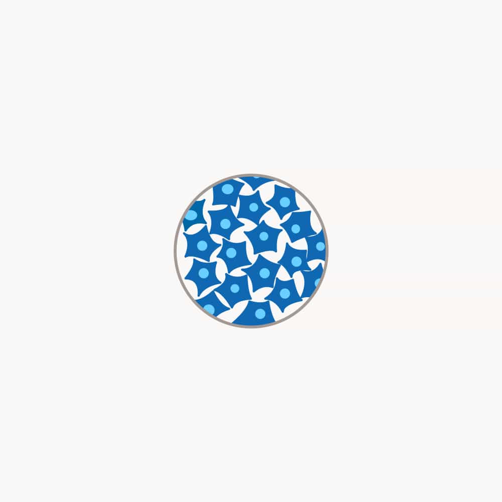 Strahlentherapie bei einem Tumor mit Krebszellen Schematische Darstellung eines Tumors mit blauen Krebszellen während einer Strahlentherapie.