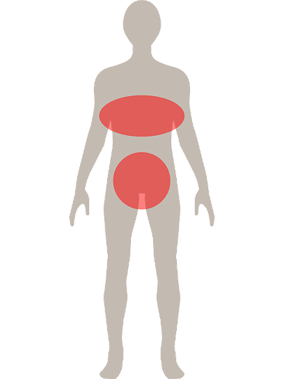 Achseln und Brust, Leistengegend und zwischen den Pobacken