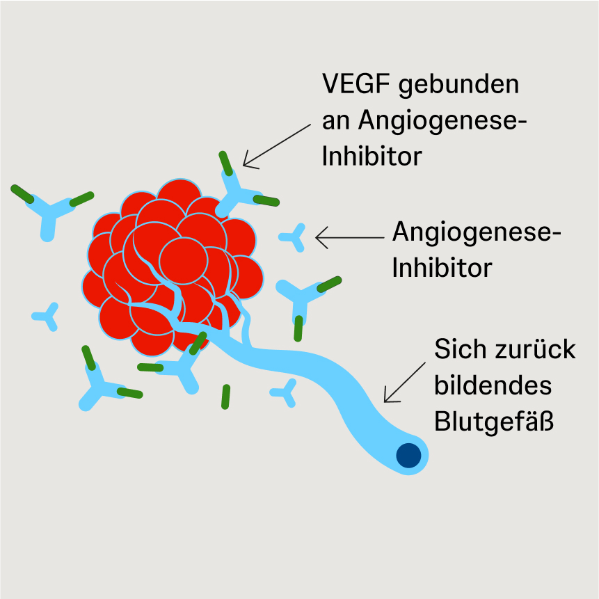 Schematische Darstellung von Angiogenese-Inhibitoren, die VEGF binden und die Signalweitergabe an Blutgefäße verhindern.
