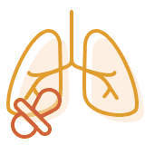 Anhaltende pulmonale Hypertonie infolge des ‚Newborn Syndromes: Illustration Lunge