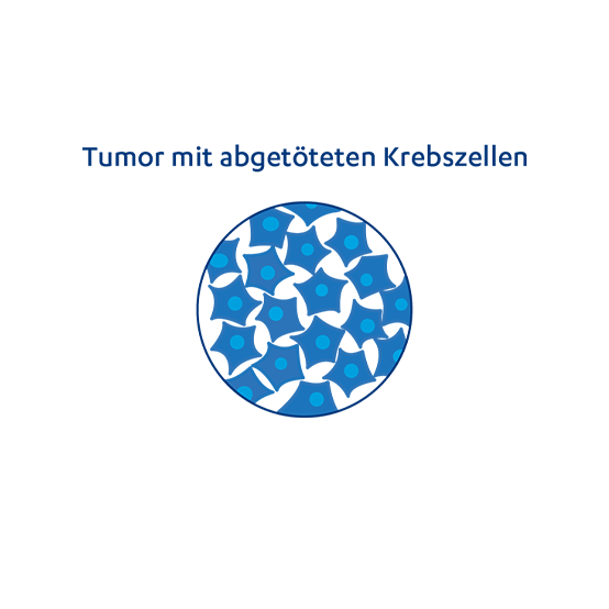 Abbildung der Funktion einer Strahlentherapie: Tumor mit abgetöteten Krebszellen