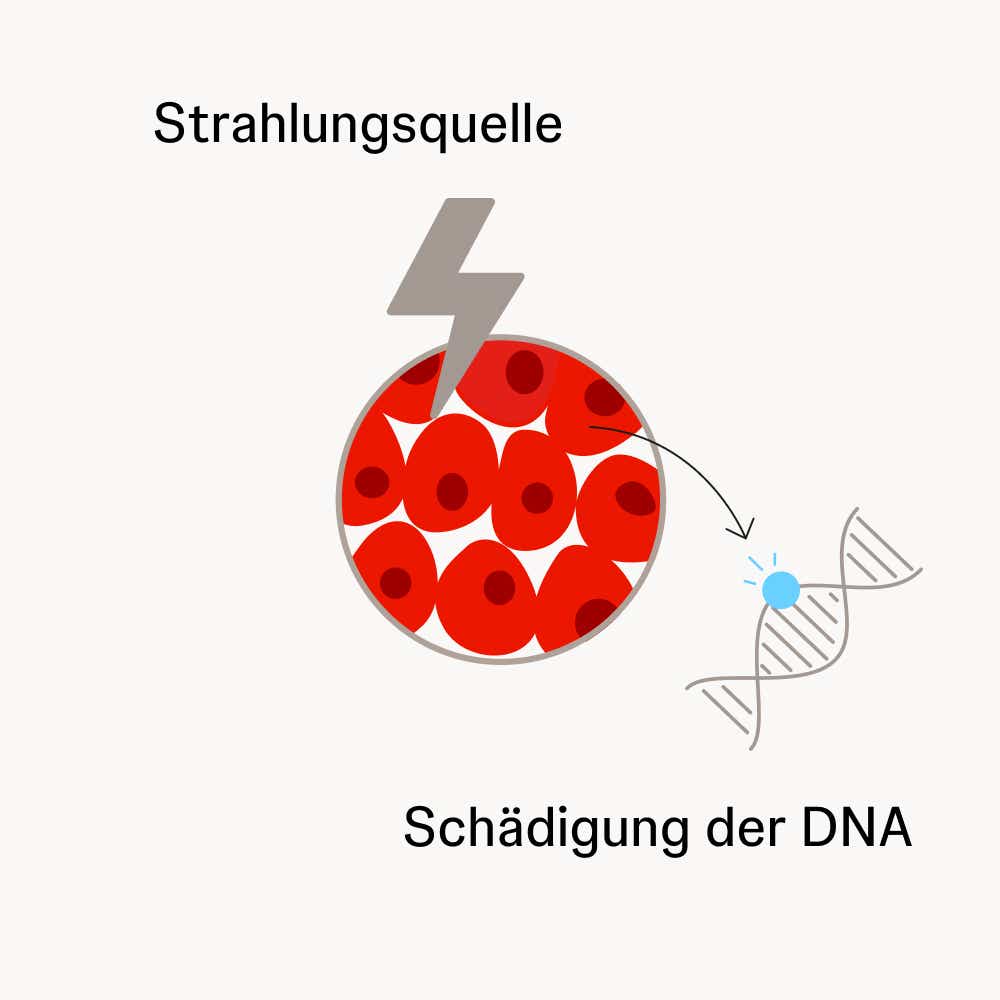 Die Strahlen schädigen die DNA in den Krebszellen und töten sie dadurch ab. Abbildung der Funktion einer Strahlentherapie: Tumor mit abgetöteten Krebszellen