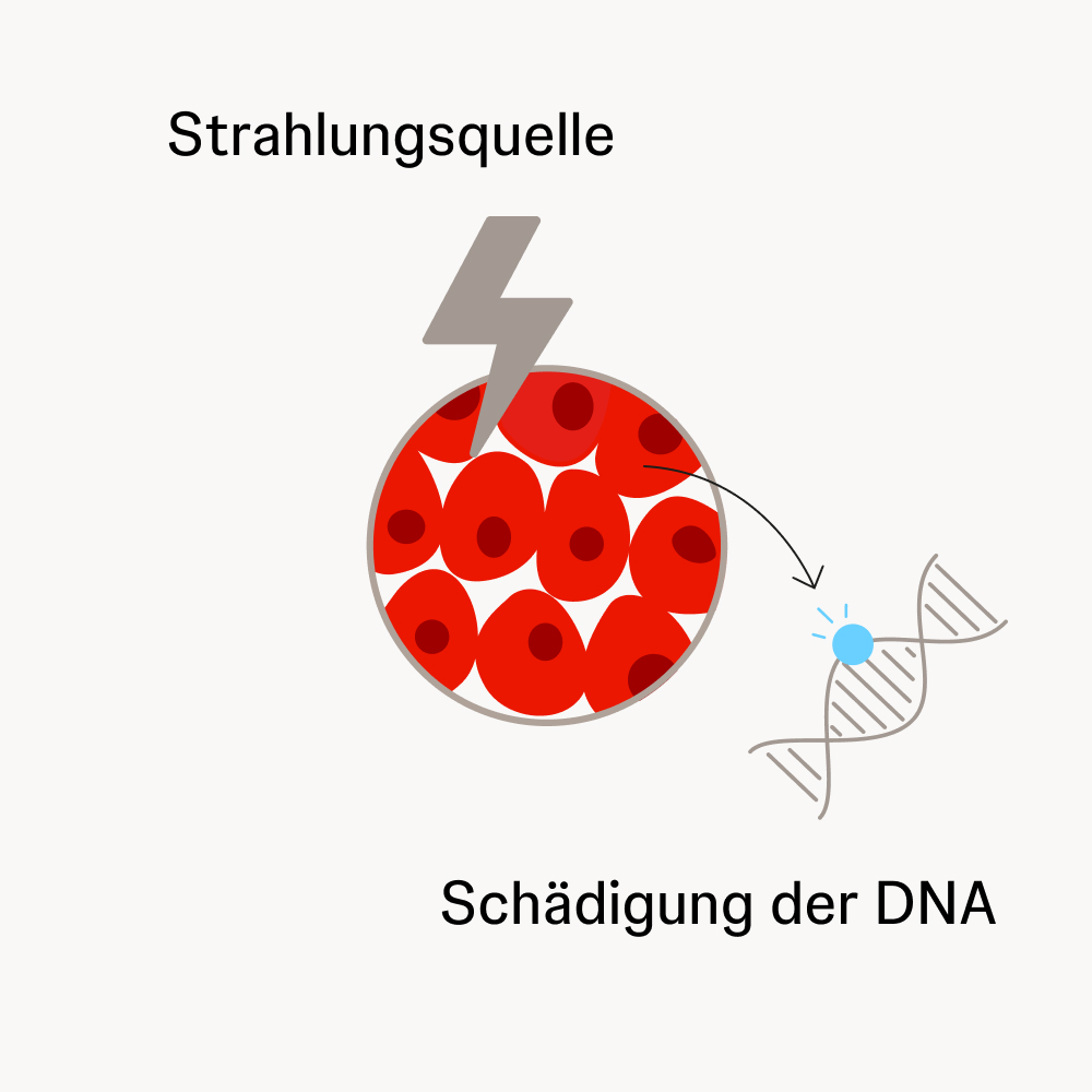 Schematische Darstellung einer Strahlungsquelle und eines DNA-Strangs mit markierter Schädigung durch Strahlentherapie.