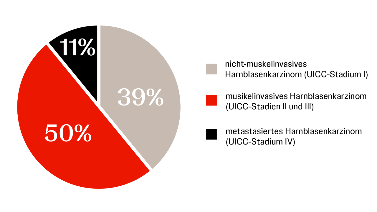 Infografik zur Verteilung der Blasenkrebsstadien bei Erstdiagnose (Männer): 50 % muskelinvasiv, 39 % nicht-muskelinvasiv, 11 % metastasiert.
