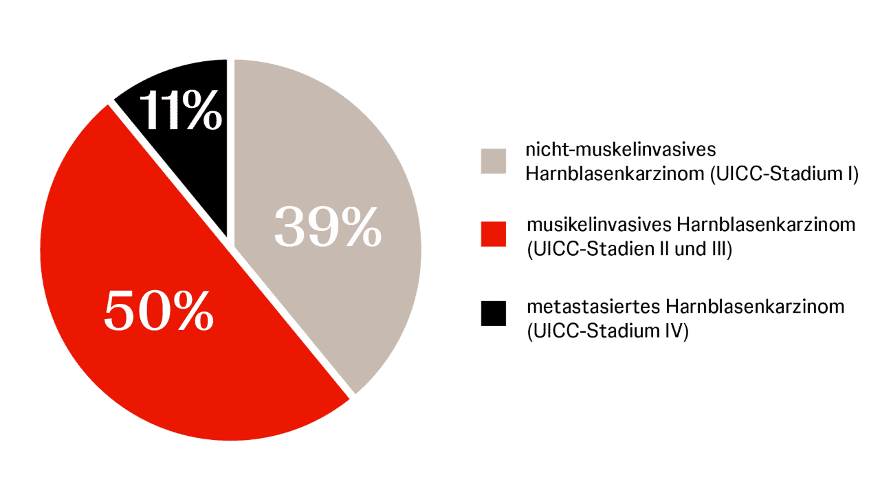 Prozentuale Verteilung der Tumorstadien bei Erstdiagnose (Männer) Infografik zur Verteilung der Blasenkrebsstadien bei Erstdiagnose (Männer): 50 % muskelinvasiv, 39 % nicht-muskelinvasiv, 11 % metastasiert.