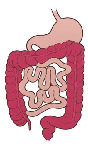 Entzündeter Dickdarm bei Colitis ulcerosa. Zeichnung des Magen-Darm-Traktes mit roter Färbung des gesamten Dickdarms, der bei der Pancolitis ulcerosa – auch ausgedehnte Kolitis genannt – entzündet ist.
