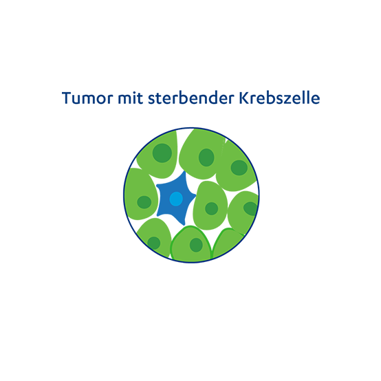 Abbildung der Funktion einer Strahlentherapie: Tumor mit sterbender Krebszelle