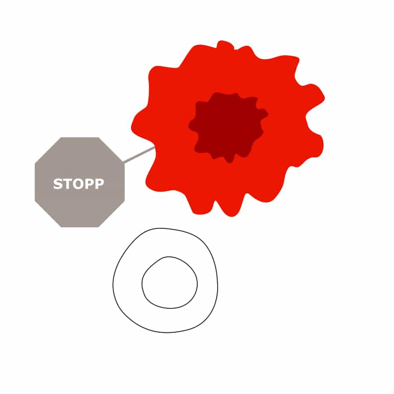 Krebszellen können sich vor dem Immunsystem tarnen Schematische Darstellung einer Krebszelle mit Stoppsignal, die von einer Immunzelle nicht angegriffen wird.