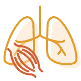 PAH in Verbindung mit anderen Erkrankungen: Illustration Lunge
