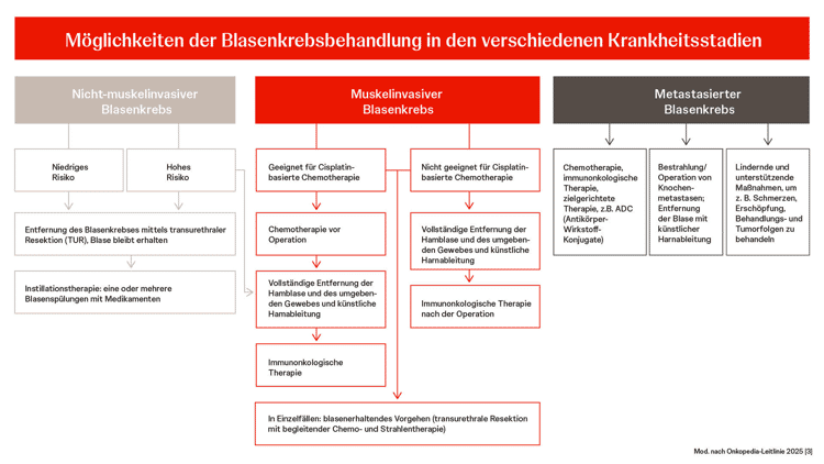 Möglichkeiten der Blasenkrebs-Behandlung nach dem Tumorstadium. Grafische Darstellung der Blasenkrebs-Behandlung in den einzelnen Stadien.