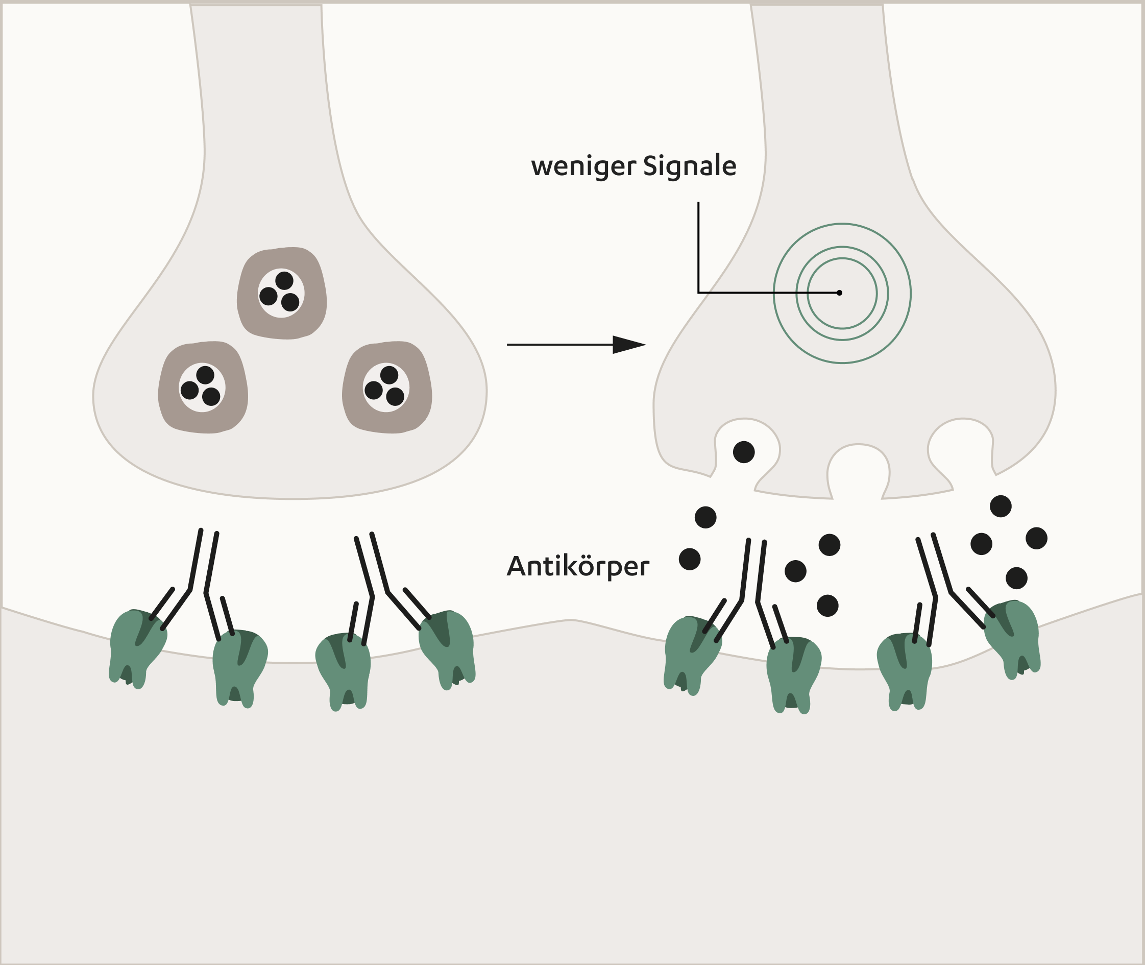 Myasthenia gravis Symptome, Ursachen und Behandlung JanssenWithMe