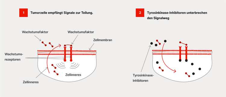 Tyrosinkinase-Inhibitoren blockieren die Wachstumssignale und bremsen so das Tumorwachstum. Tyrosinkinase-Inhibitoren blockieren die Wachstumssignale und bremsen so das Tumorwachstum.