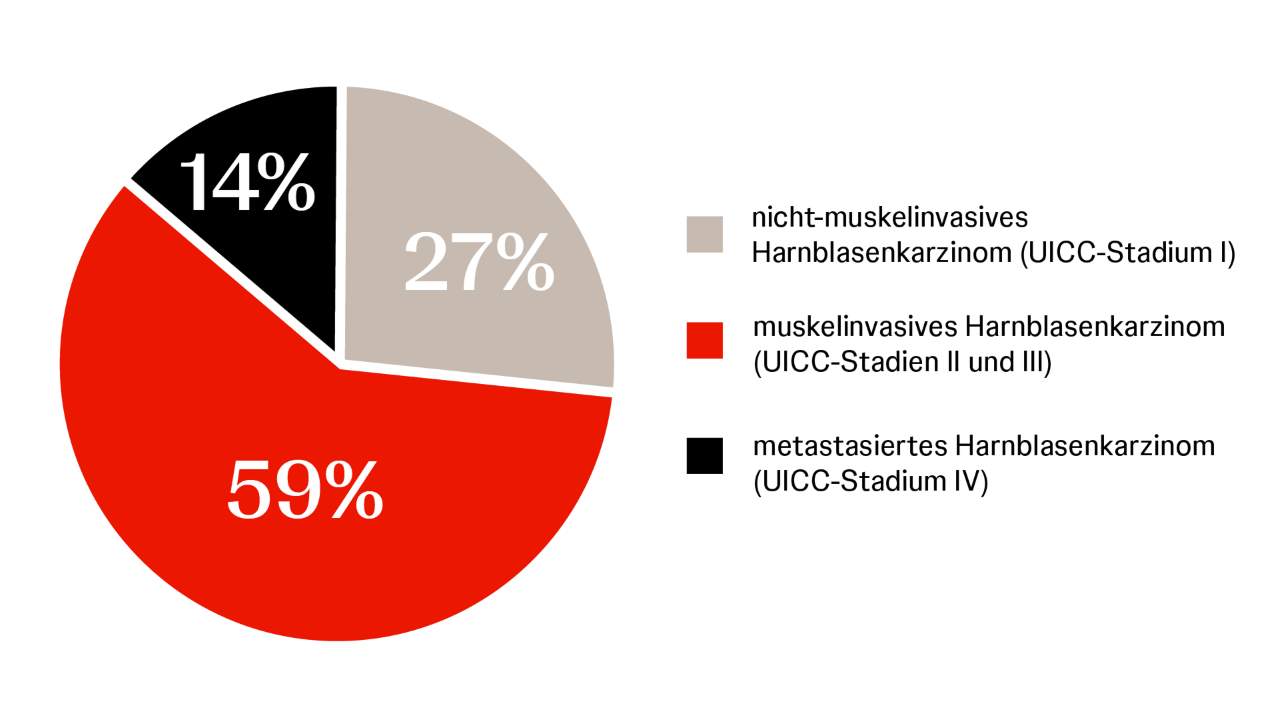 Infografik zur Verteilung der Blasenkrebsstadien bei Erstdiagnose (Frauen): 59 % muskelinvasiv, 27 % nicht-muskelinvasiv, 14 % metastasiert.