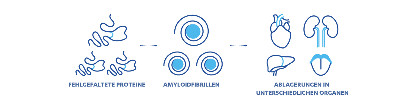 Amyloidose: Diagnose, Symptome & Behandlung | | JanssenWithMe