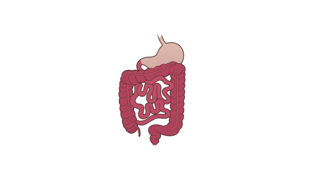 Ilustration Morbus Crohn Ilustration Morbus Crohn