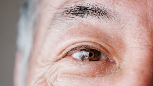 Ein Mann mit Morbus Crohn und einer extraintestinalen Manifestation an den Augen. 