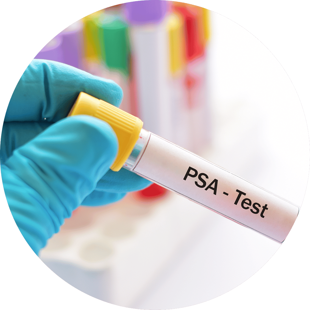 PSA Wert Infos Zu Test Und Alterstabelle JanssenWithMe psa-wert-infos-zu-test-und-alterstabelle-janssenwithme