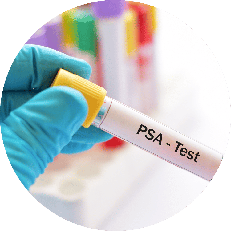 PSA-Wert - Infos zu Test und Alterstabelle | JanssenWithMe