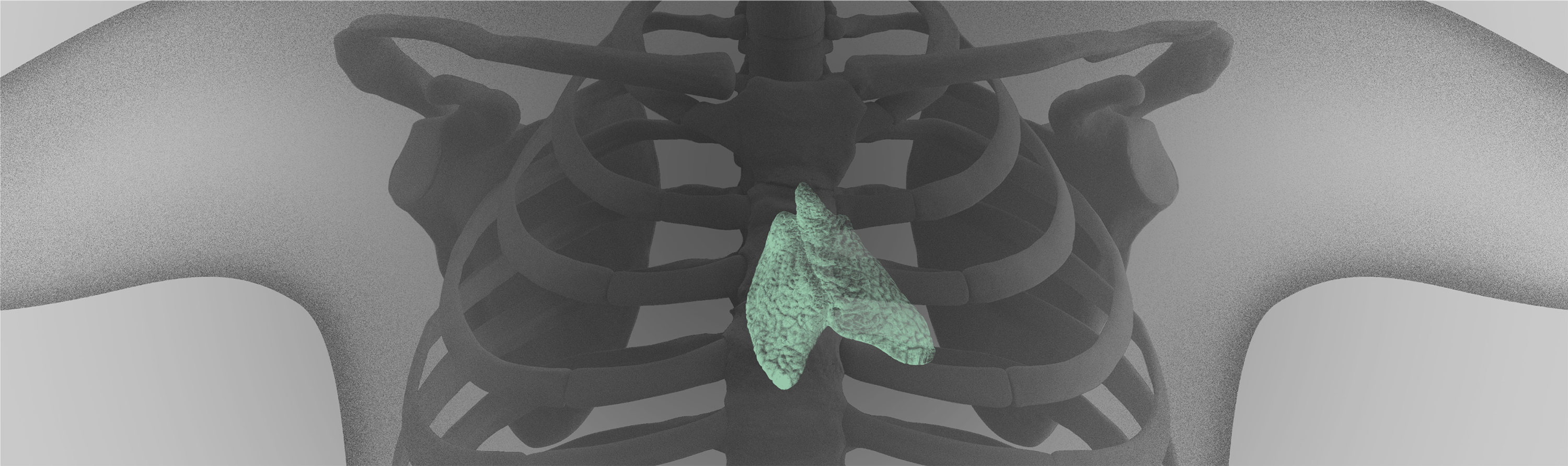 Visualisierung der Thymusdrüse im Oberkörper, ein Organ mit möglicher Beteiligung an der Entstehung von Myasthenia gravis