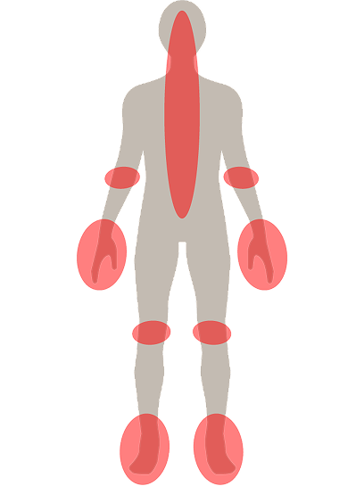Nacken, Rumpf und Rücken, Ellenbogen, Hand- und Fingergelenke, Knie, Fuß- und Zehengelenke