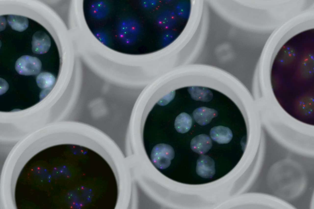 Schiff - Is Arthritis Hereditary_ .png