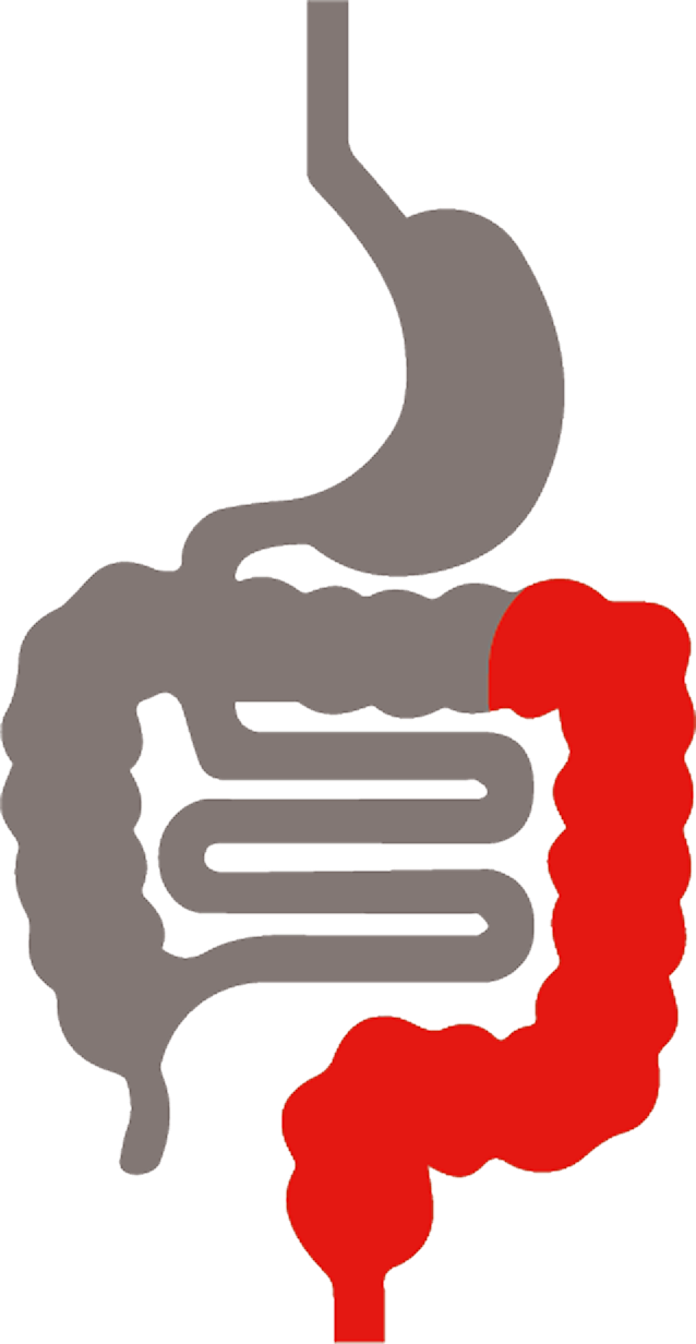 Die Lokalisation von Colitis ulcerosa