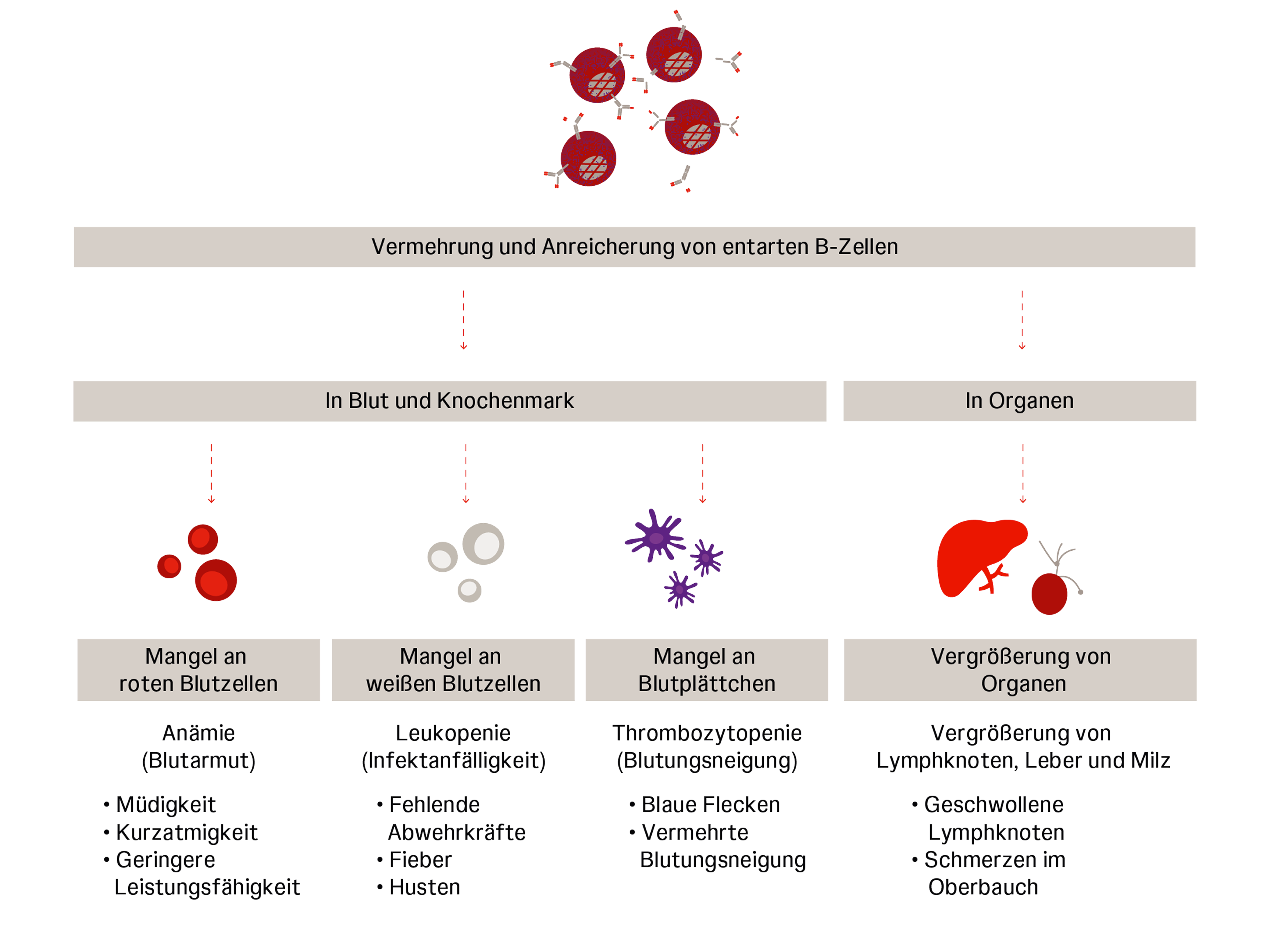 Unterschiede im Blutbild bei Leukämie