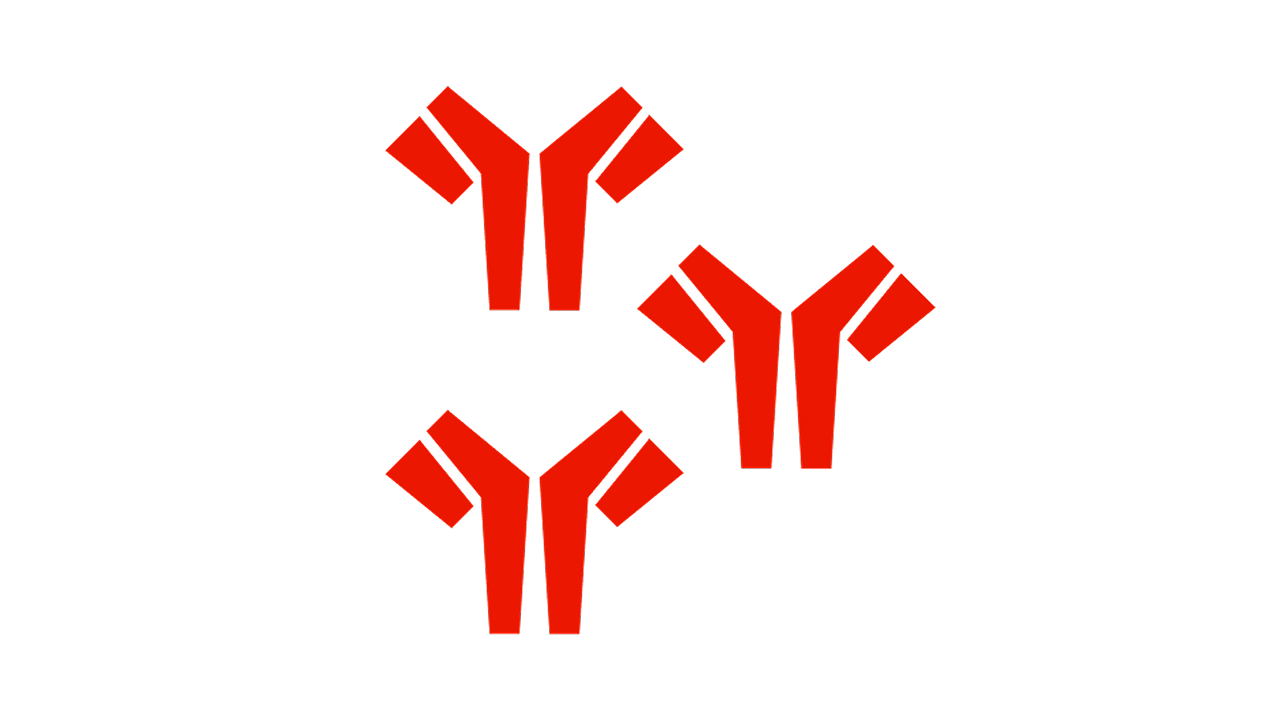Al-Amyloidose Formen Darstellung von Antikörpern als Ursache der AL-Amyloidose