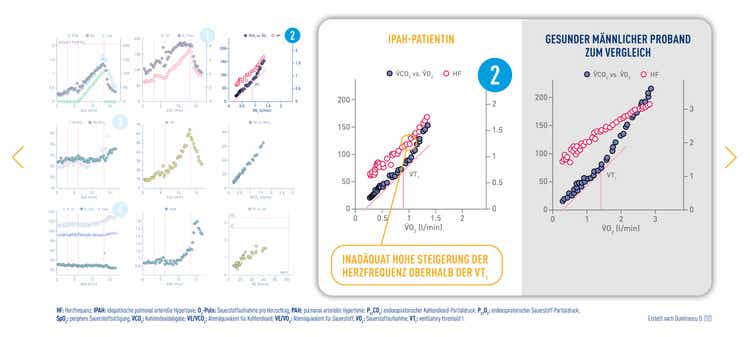 Typische Anzeichen für PAH in der Spiroergometrie: Auswertung einer IPAH-Patientin in der 9-Felder-Grafik nach Wasserman [12]