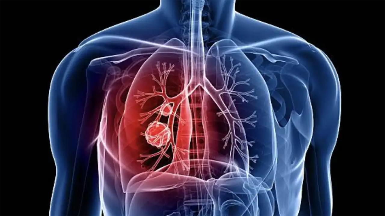 Symbolbild zielgerichtete Therapie Symbolbild zielgerichtete Therapie