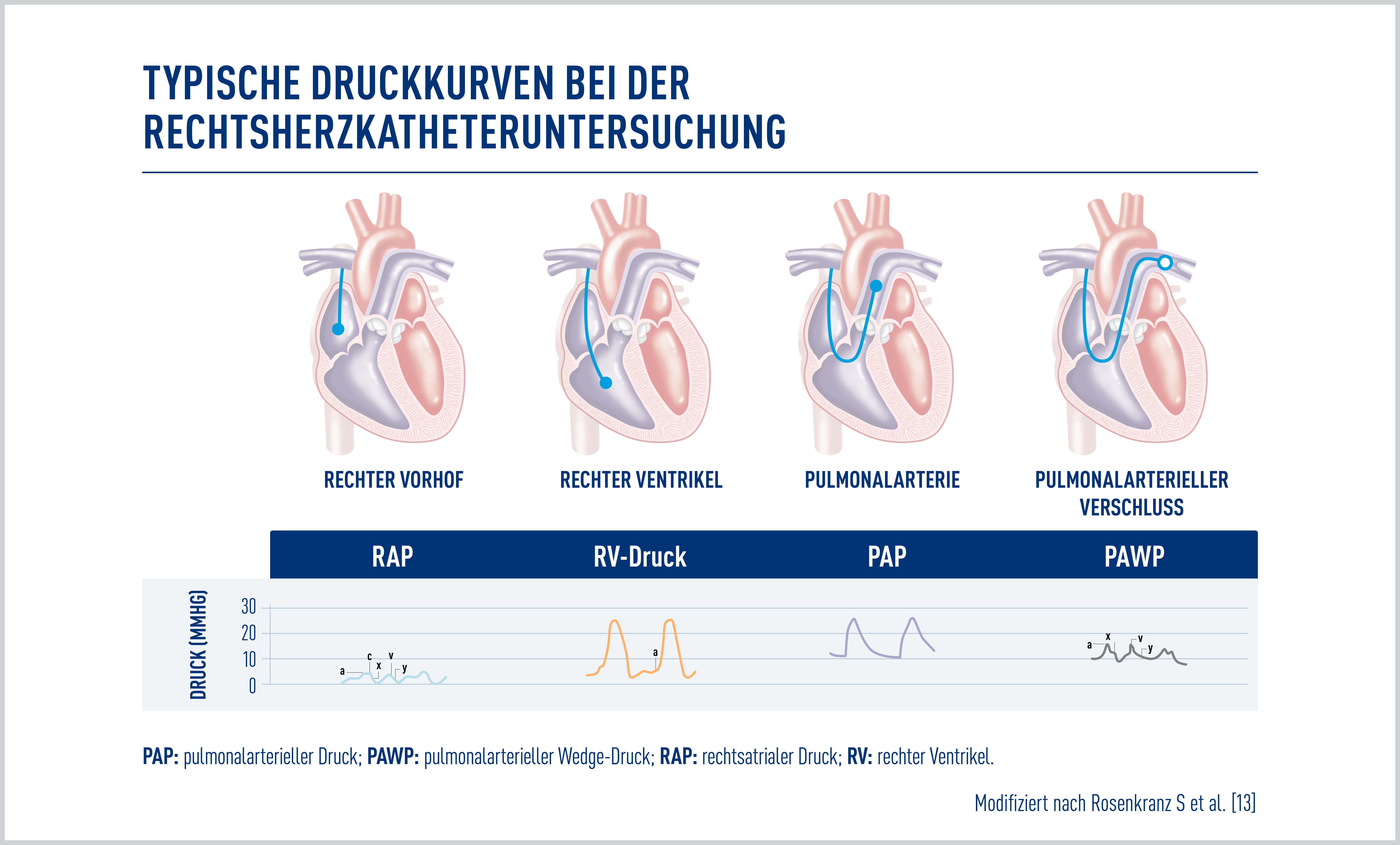 Diagnose der P(A)H Janssen Medical Cloud