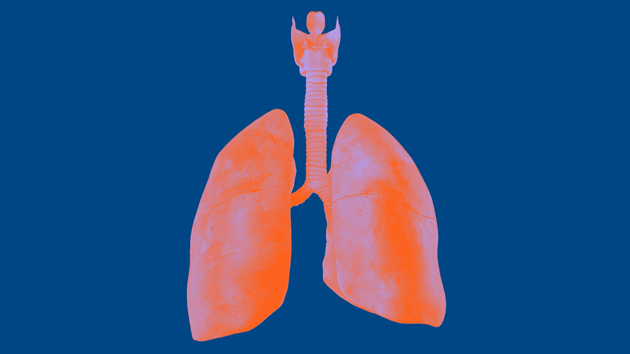 NSCLC nicht-kleinzelliges Lungenkarzinom: Epidemiologie, Symptome, Diagnostik und Therapie des NSCLC plakatives Bild einer Lunge
