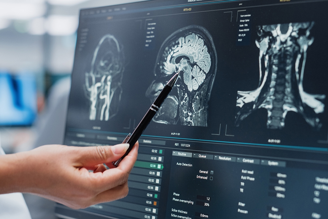 Hochauflösende radiologische Aufnahmen eines Kopfes.