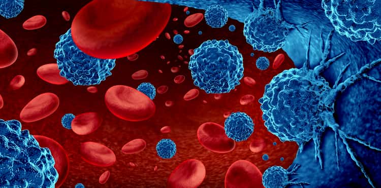 Das multiple Myelom Das multiple Myelom