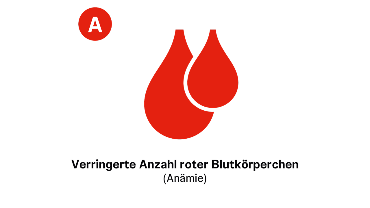 Das dritte CRAB-Kriterium steht für A wie Anämie definiert durch einen reduzierten Hämoglobin-Gehalt